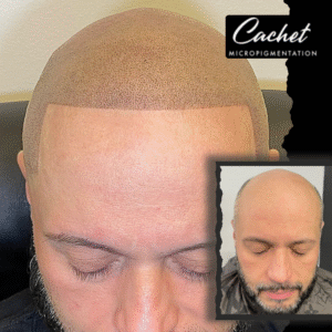 FULL SMP PROCEDURE
